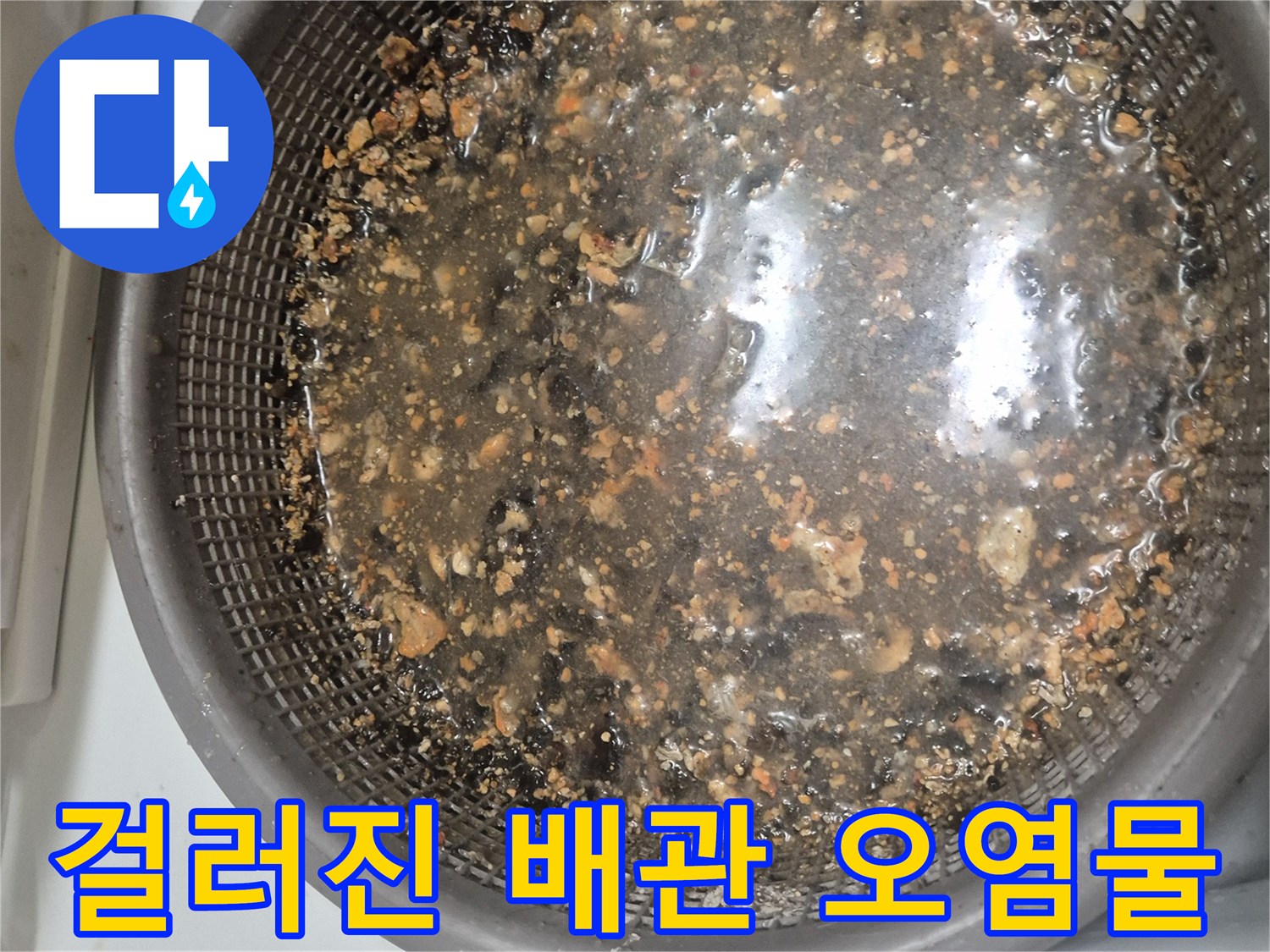 석션 작업 후-채에 걸러진 것으로 보이는 이물질들